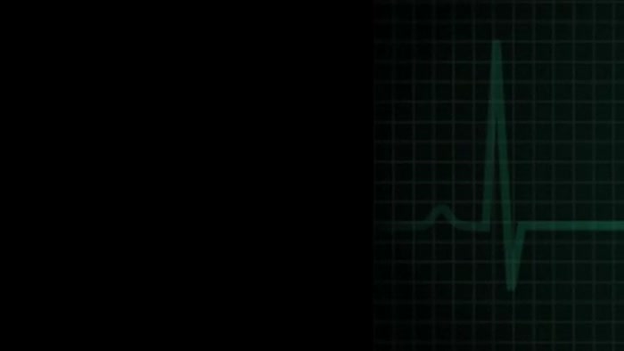 Broadband Epidemic (AMI)